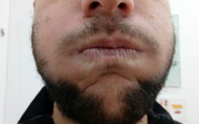 El estrés engorda donde menos lo deseas